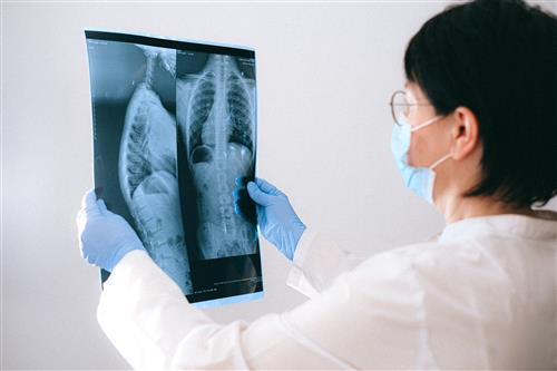 radiology xray stock photo